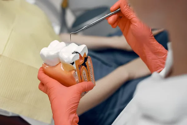 Root Canal Treatment
