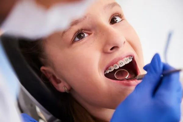 Orthodontic Treatment